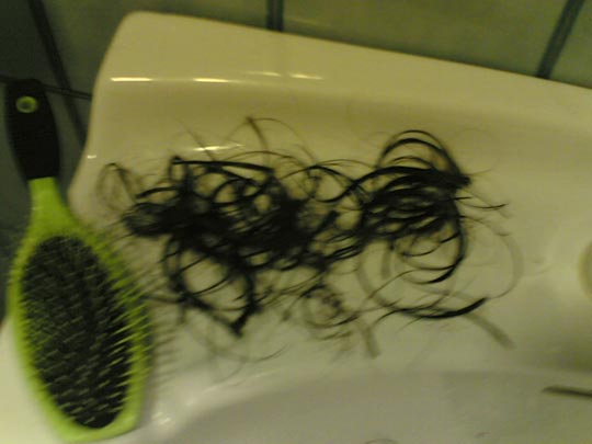  CARLOS MORA [Villahermosa-Ciudad Real] _ caída de pelo 