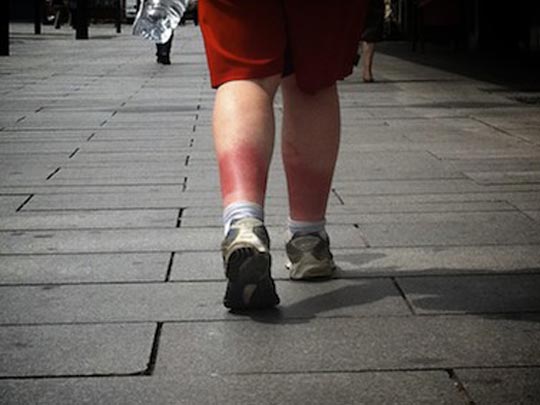  JORDI ALCARAZ [Pamplona] _ pa s.o.s. 