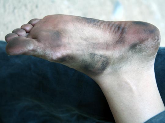  EDU SOTO _ piesnegros 