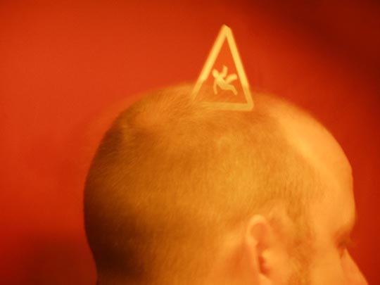  FRANCESC FÀBREGAS _ injerto 