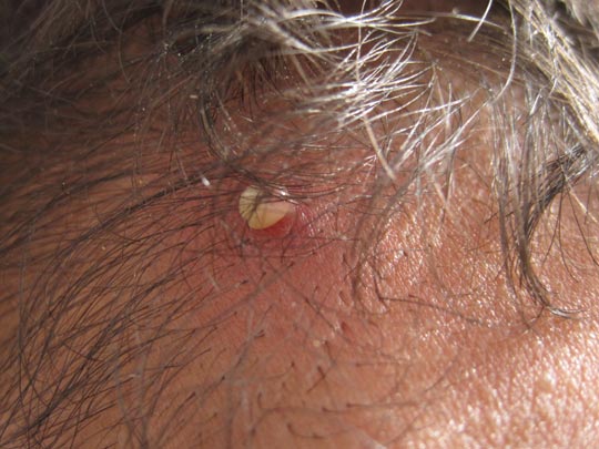  JON SISTIAGA _ el grano de mario 