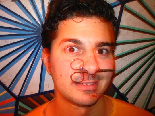  MIKEL URMENETA _ herida 