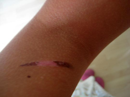  MARTA PEIRÓ _ ...y yo me quemo 