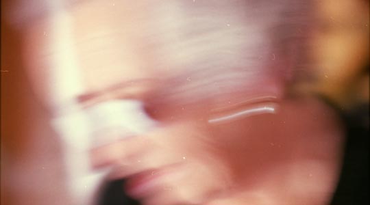  SARA COSTA _ trombosis 